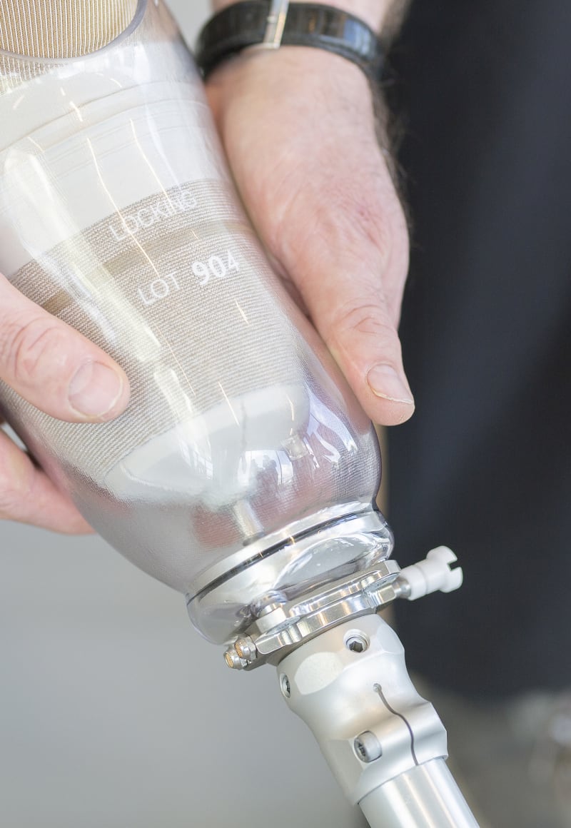 La historia de Flore Prótesis Össur