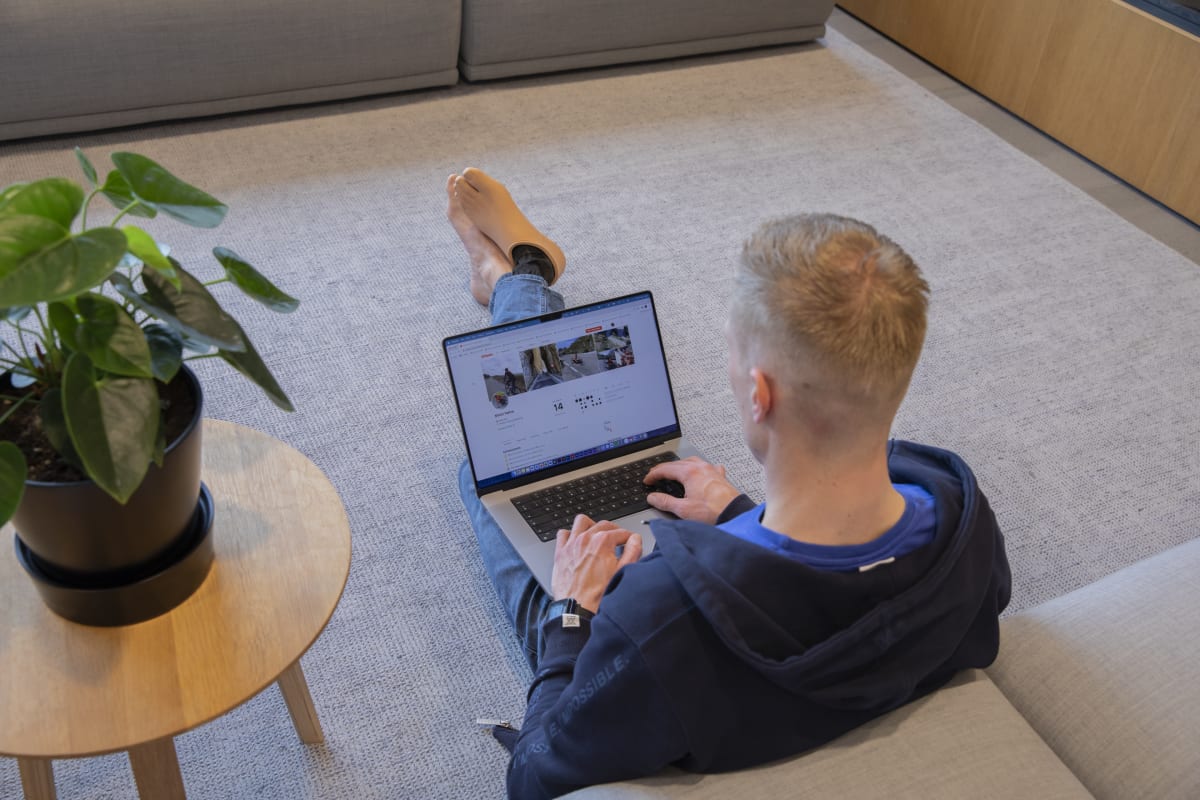 Pijn Syndroom En Vervorming Van De Voet Met Artritis Varicose-aderen in