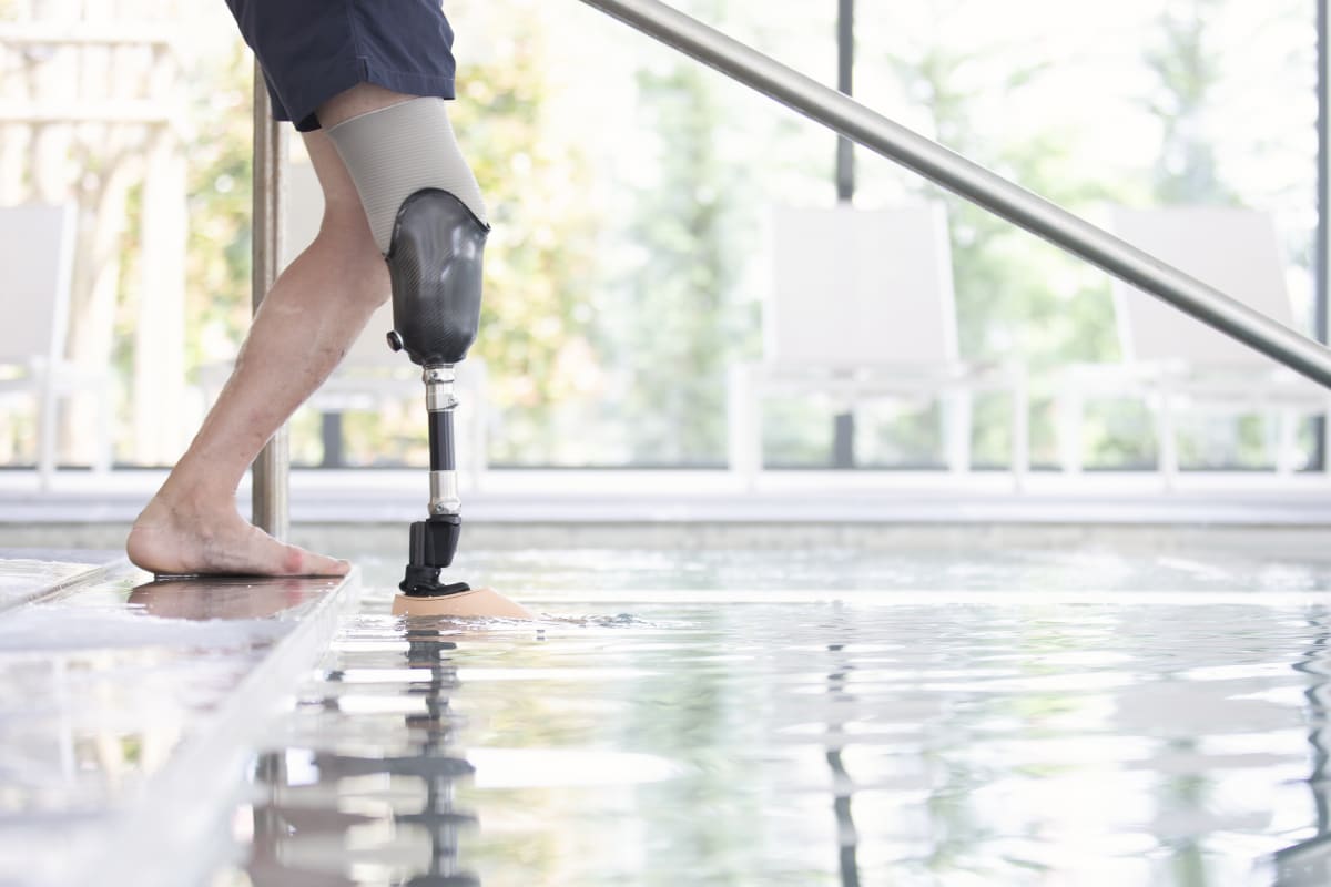 ProFlex® Family—Innovative Prosthetic Foot Designs for Mobility.