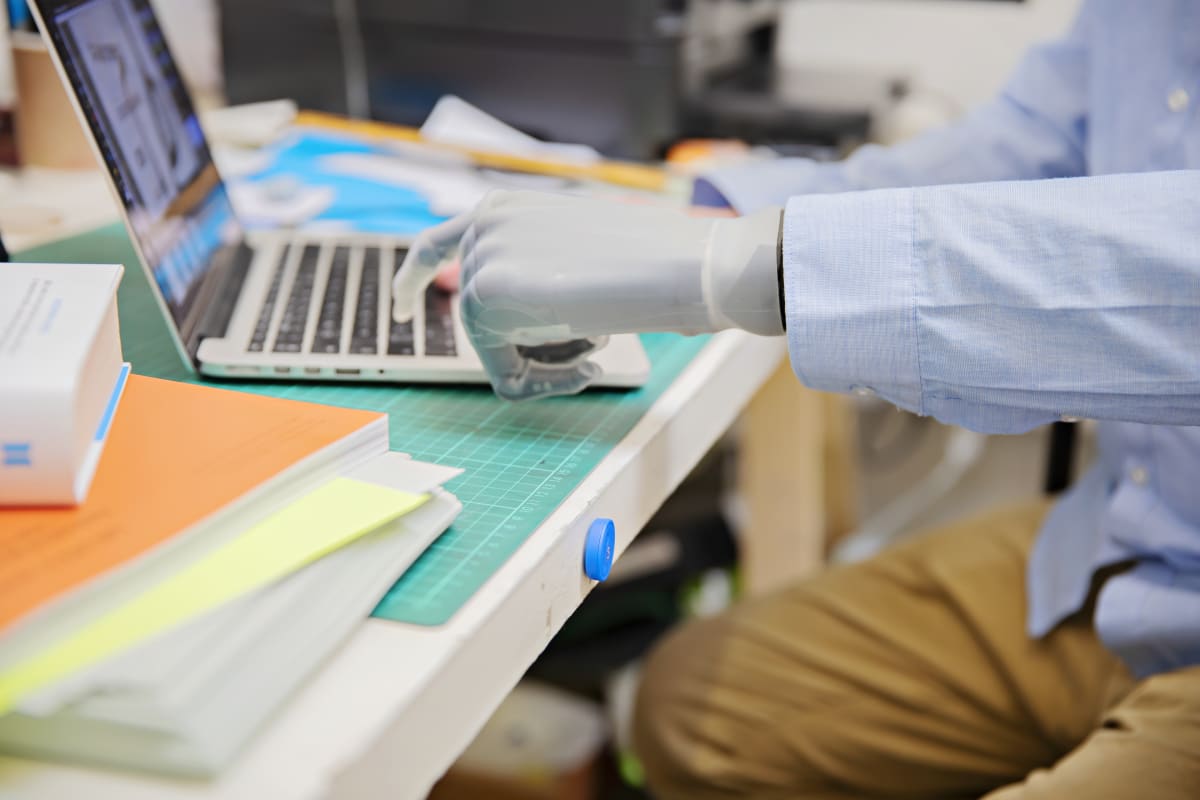 Informatie voor arm- of handgeamputeerden | Ossur NL