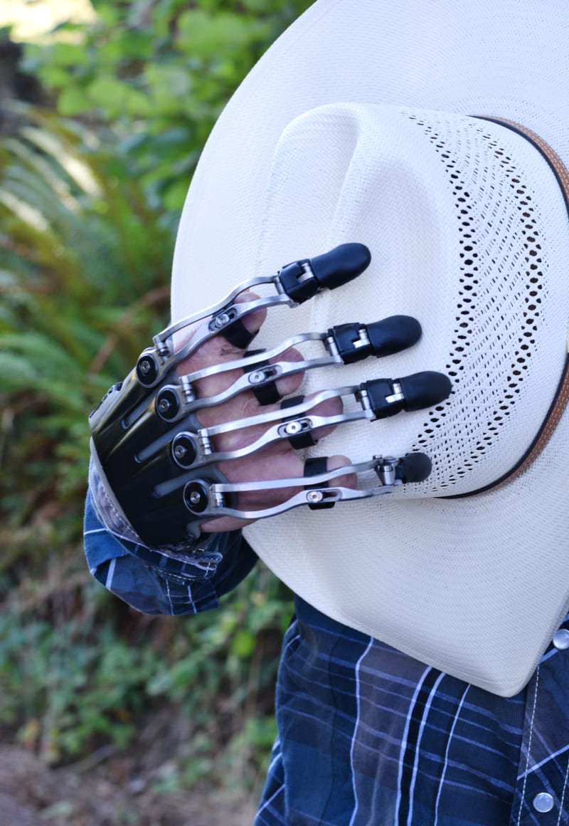 Össur Erwirbt Naked Prosthetics – WMSN
