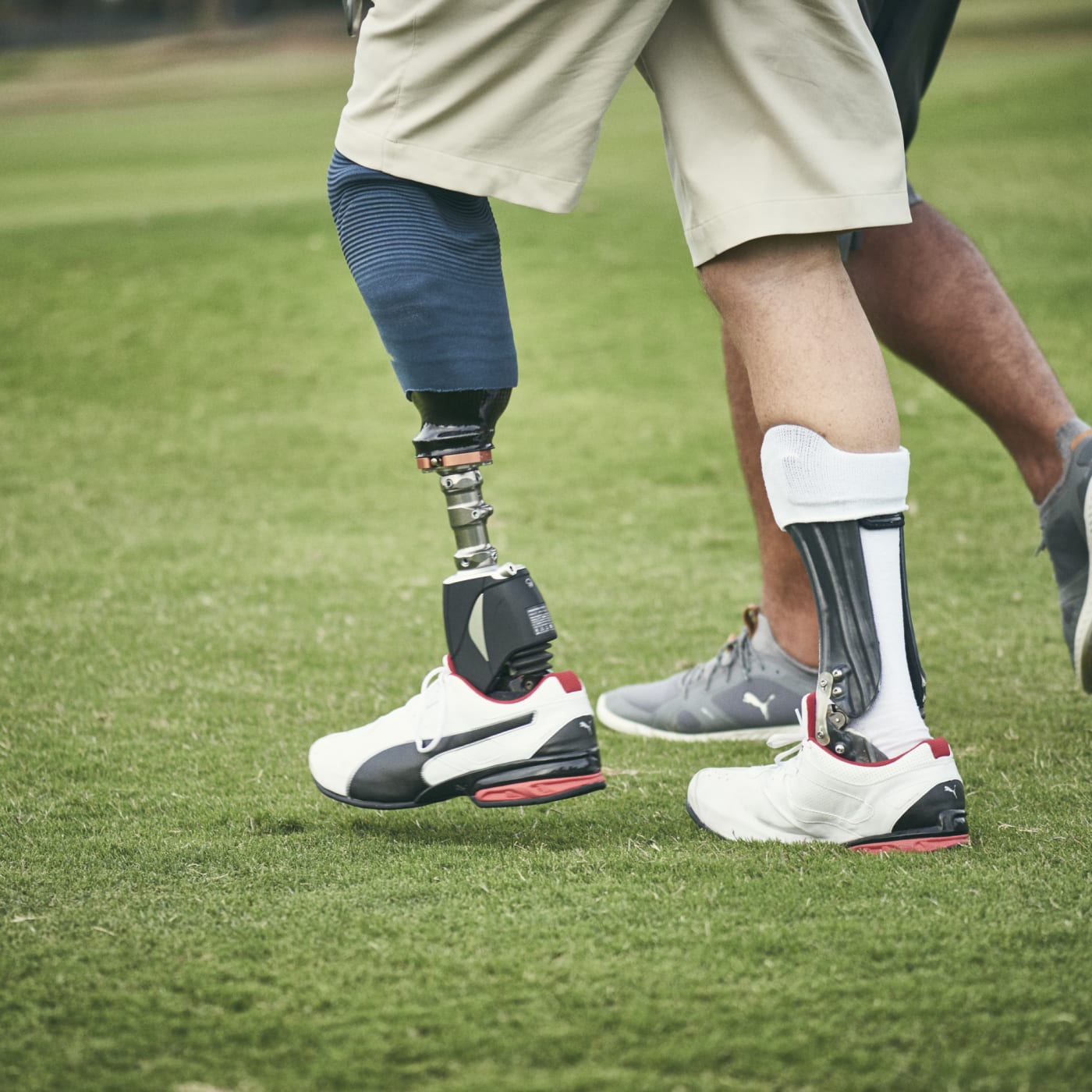 Össur Bionics Fitting Guidelines .