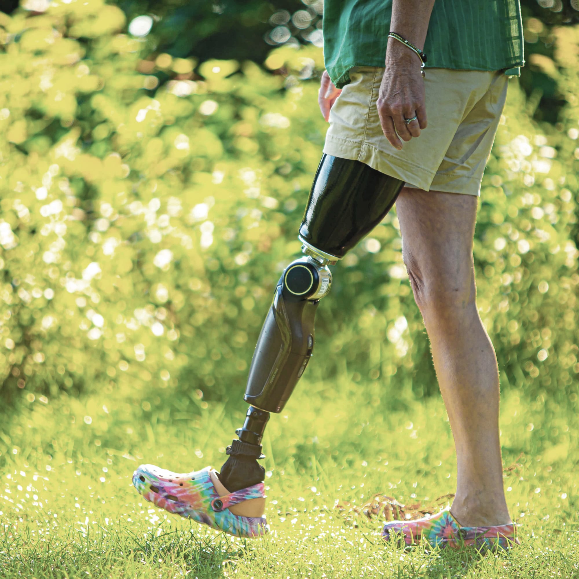 What Are The Parts of a Prosthetic Leg? Össur Prosthetics
