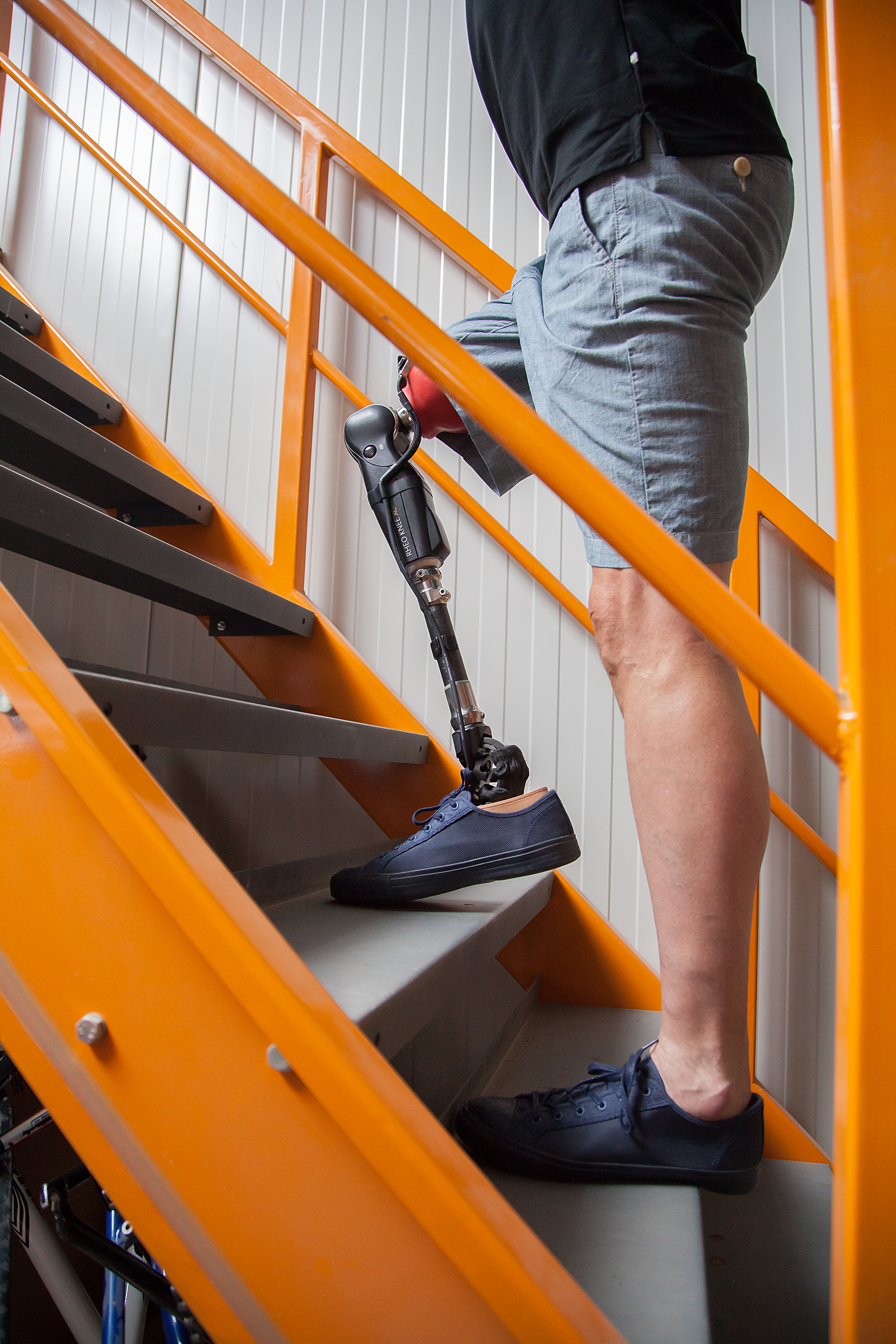 Rheo Knee XC - Bionic Prosthetic Knee