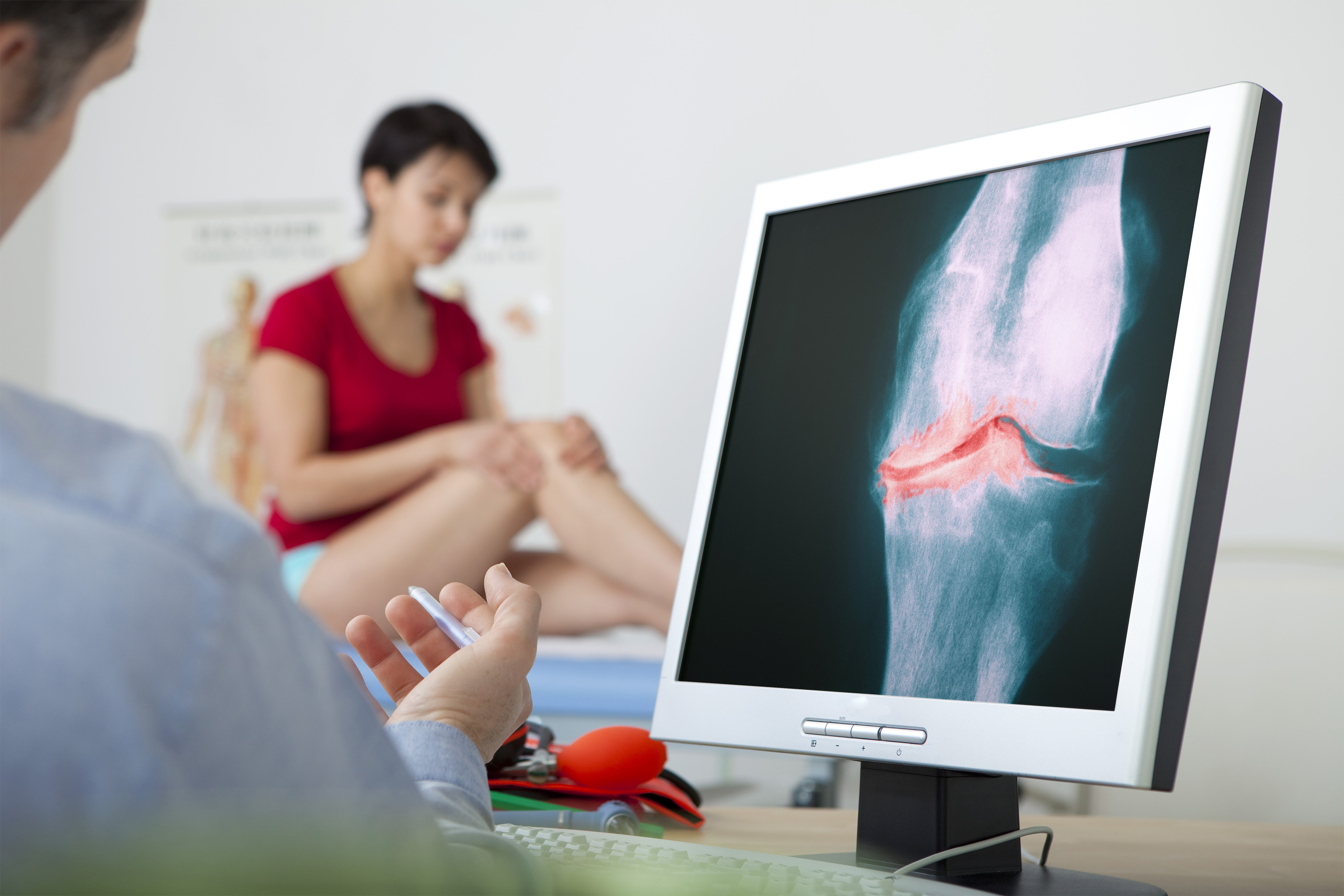 What is Osteoarthritis? | Össur UK