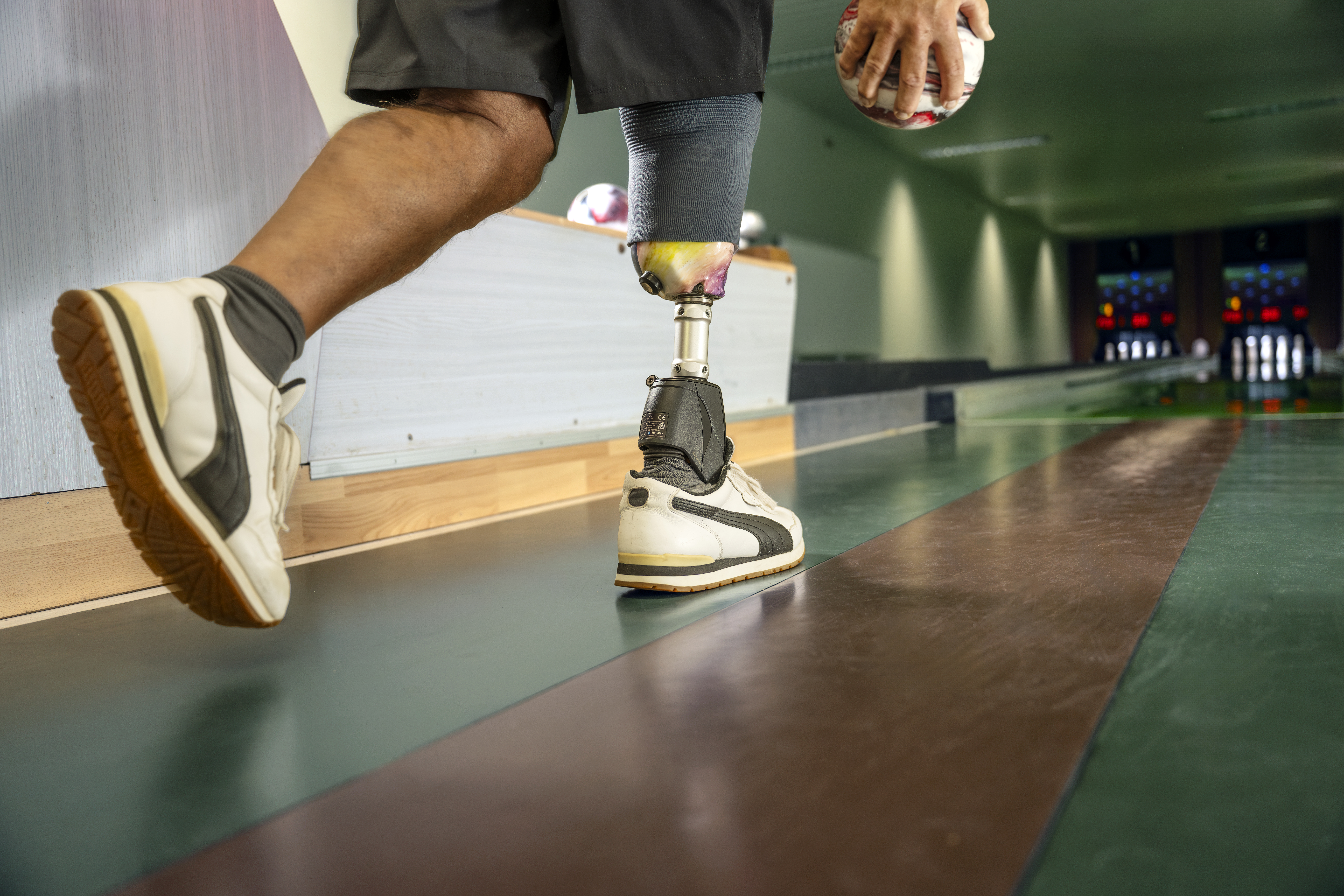 Bionische Prothesen - Meilensteine zukunftsweisender Orthopdietechnik