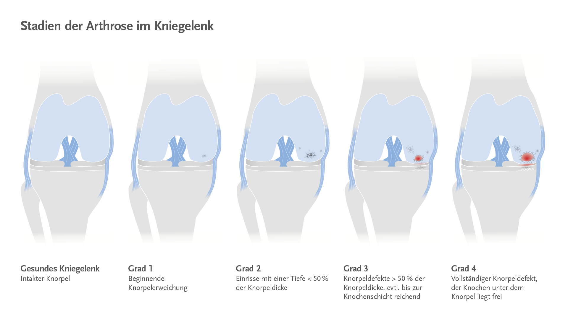 einzelne knstliche wimpern Kurze knstliche Wimpern fr Anfnger